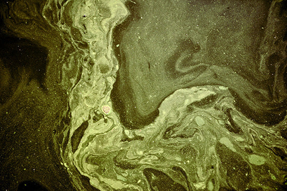 PFAS's Potential Health Effects During Pregnancy